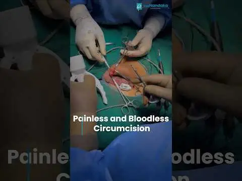 Advanced Circumcision Procedure Video | ZSR Circumcision in Hyderabad