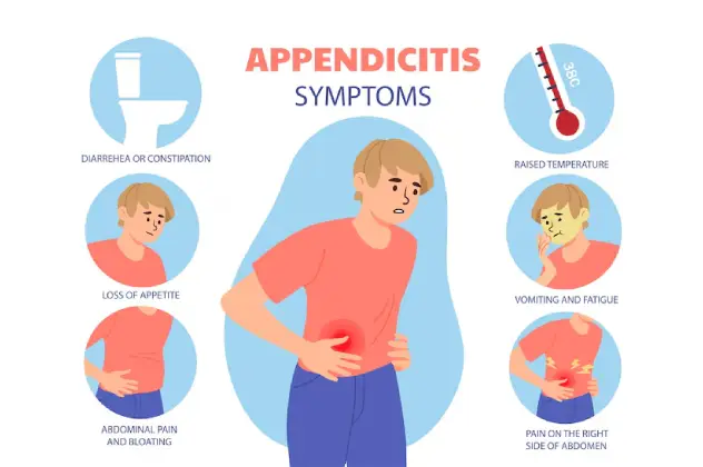 Symptoms of Appendicitis