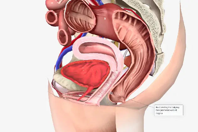 Rectal Prolapse treatment