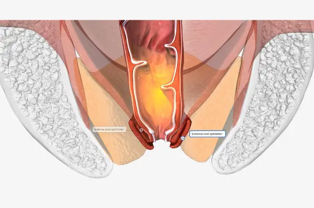 Anal Fistula